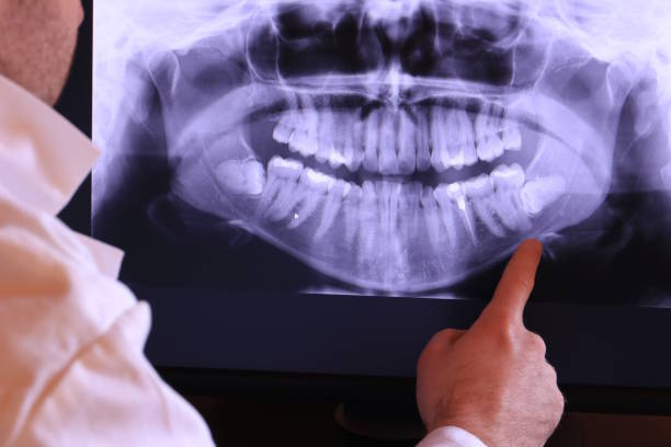 Best Weekend Emergency Dentist in Elida, OH