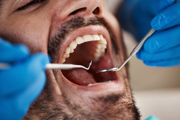 Best Emergency Dental Care for Broken or Chipped Teeth in Elida, OH